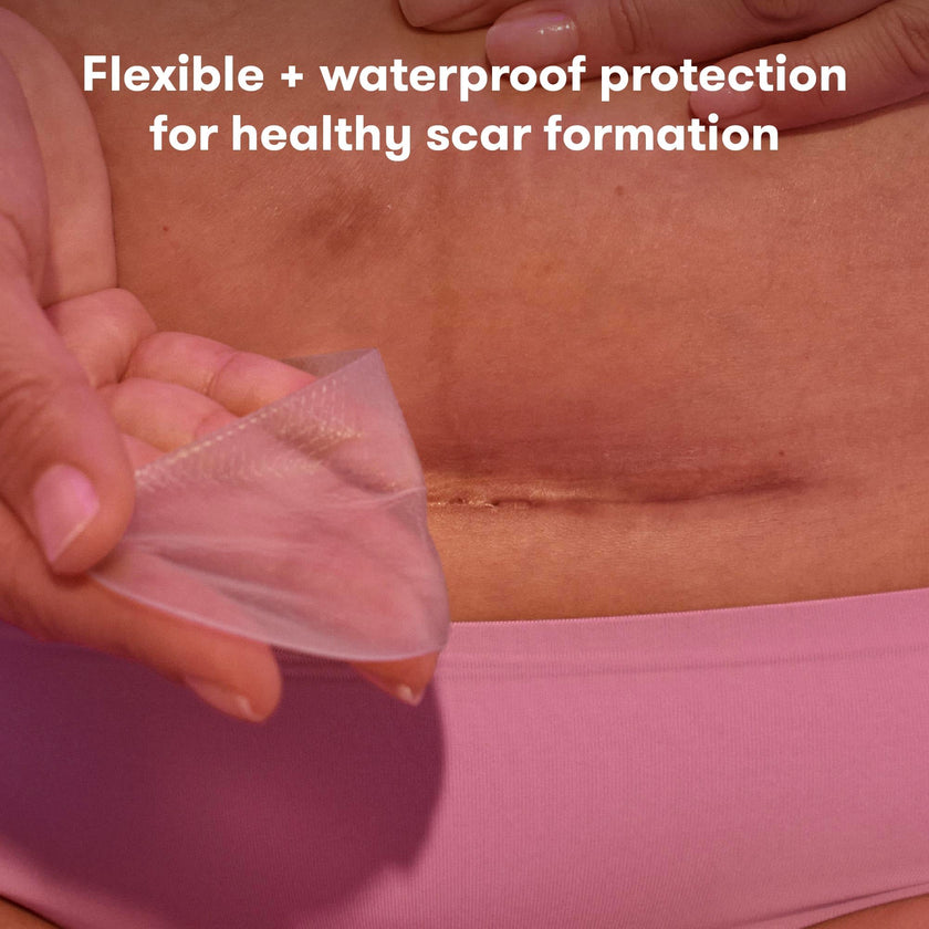 fridamom C-Section Scar Patches